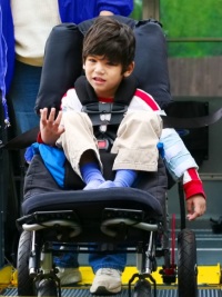 лечение миопатии Дюшена лечение миопатии Дюшена